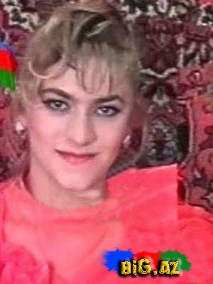 Şou-biznesimizin plastik əməliyyat keçirən simaları